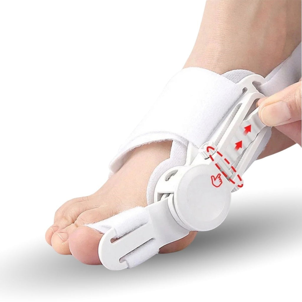 Ayarlanabilir Ayak Baş Parmak Kemik Düzeltici – Halluks Valgus (Bunyon) Aparatı, Gece Gündüz Kullanıma Uygun Ayak Düzeltme Ateli