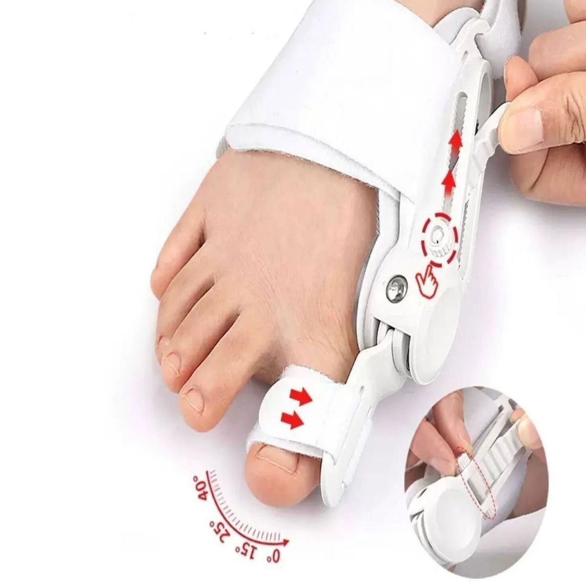 BUFFER Ayarlanabilir Ayak Baş Parmak Kemik Düzeltici – Halluks Valgus (Bunyon) Aparatı, Gece Gündüz Kullanıma Uygun Ayak Düzeltme Ateli